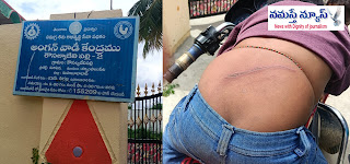 అంగన్వాడీ పంతులమ్మ క్రమశిక్షణ పేరుతో బాలుడి పై దాడి..?
